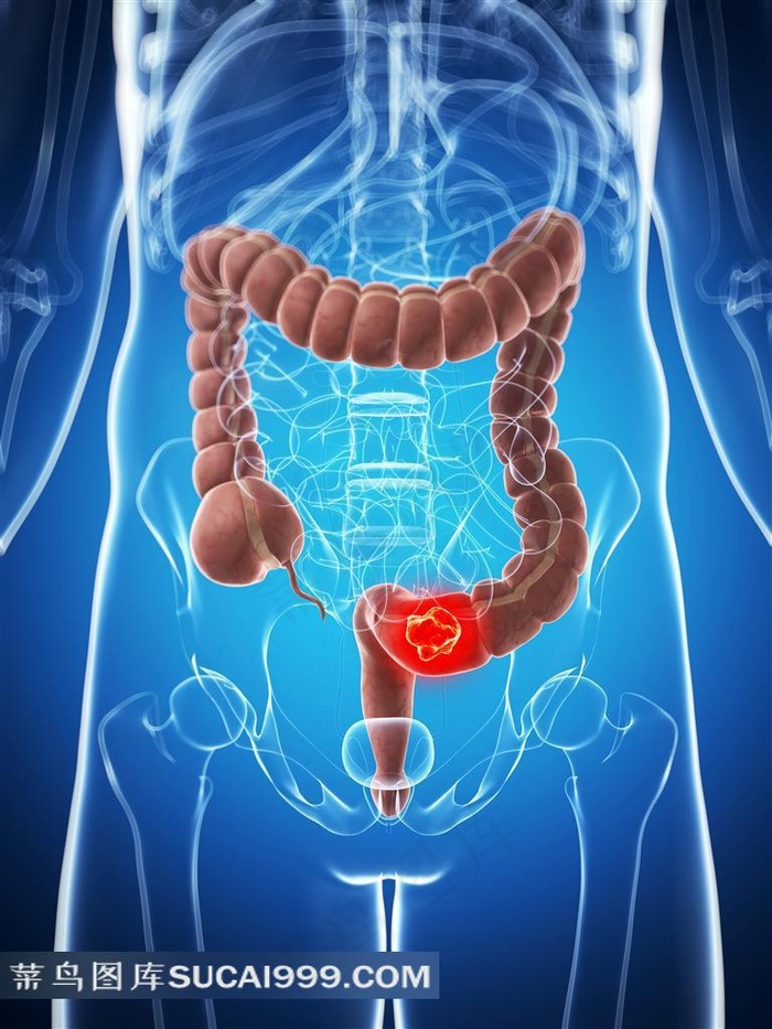大肠身体器官X光片高清图片摄影
