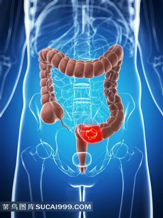 大肠身体器官X光片高清图片摄影