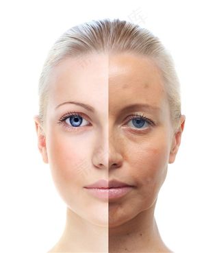 左右脸肤质对比图美容图片