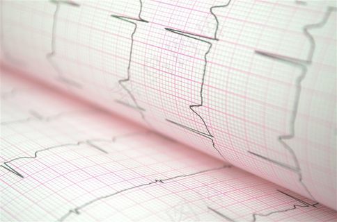 心电图检查结果高清图片