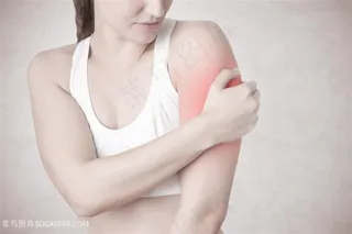 关节疼痛的女子