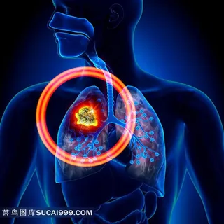 医学人体透视图素材