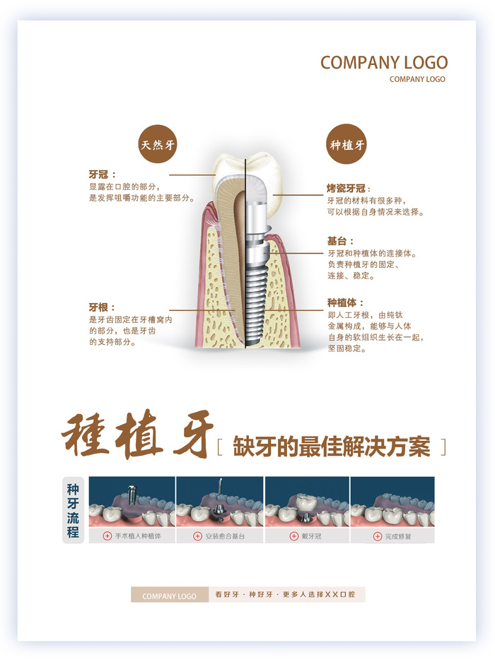 口腔诊所牙科无痛微创种植牙宣传广告06