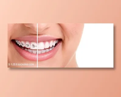 带牙套的美女高清图 带牙套的美女高清图