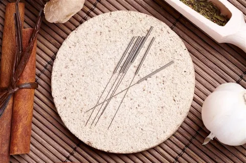 针灸用的银针 针灸用的银针