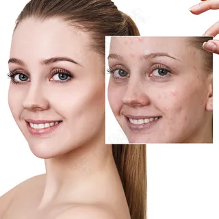 美容护肤前后对比图片