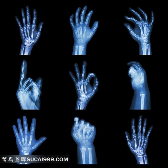 手部x光扫描