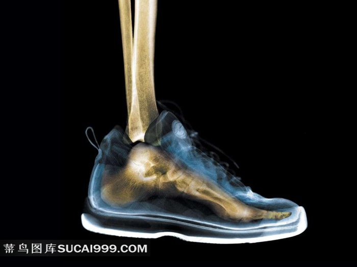X光脚趾骨鞋子透视图素材
