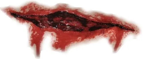 疤痕 PNG免抠(674x275)