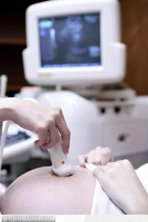 妇产小儿医疗-正在做B超的孕妇