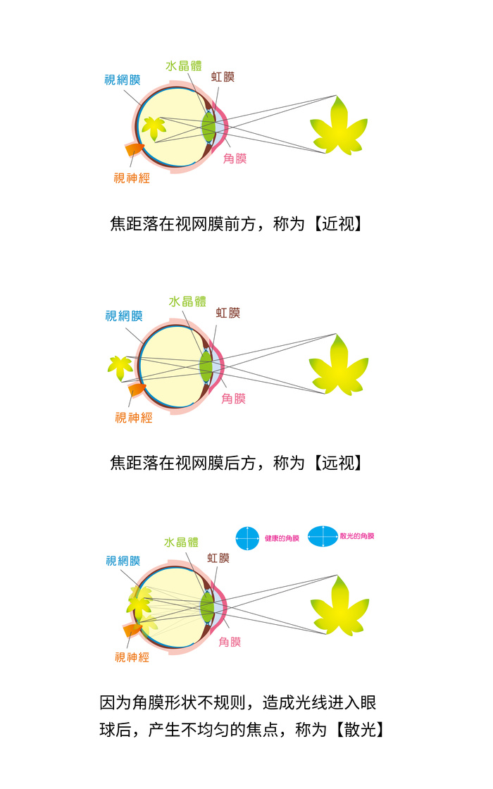 近视远视散光挂画