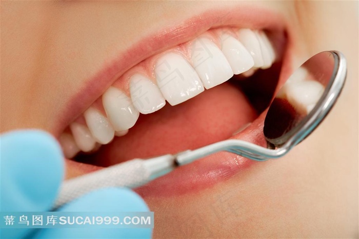 开心美牙洁牙手术图片反光镜