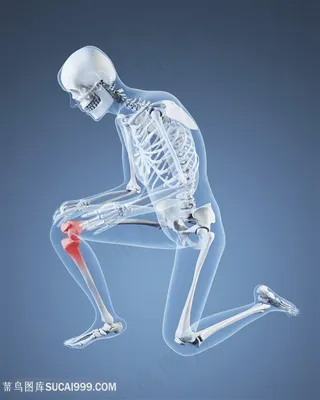 腿部疼痛的人体模型高清图片