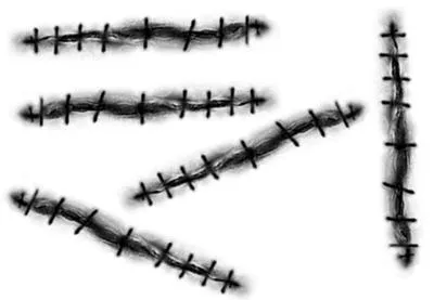 疤痕 PNG免抠(400x277)