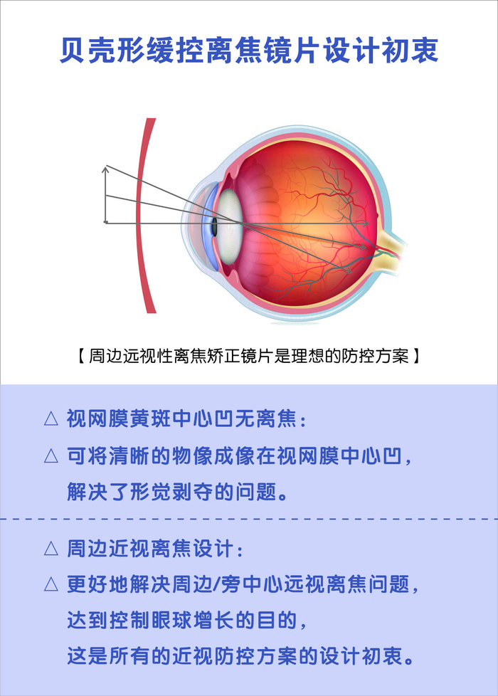 眼镜海报图