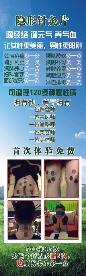 隐形针灸片展架