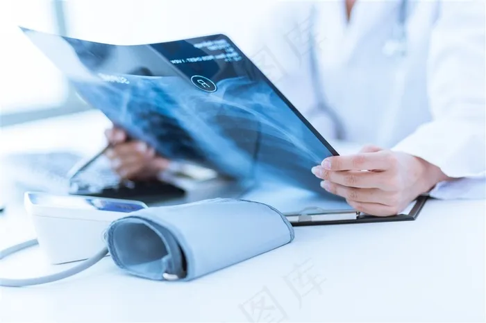 拿着胸腔造影观察的医生高清图片