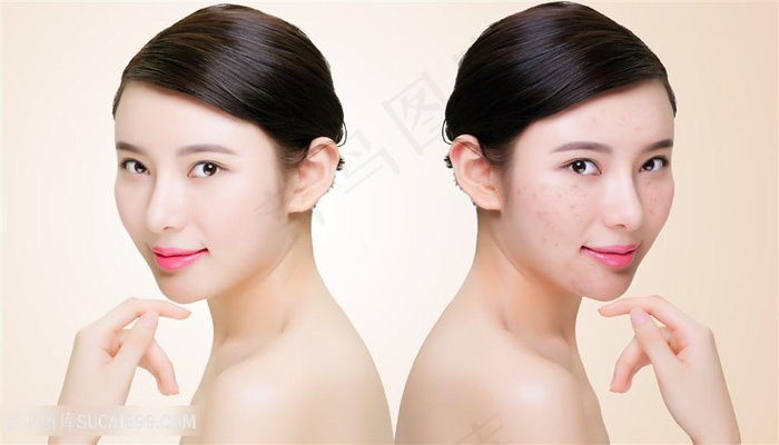 痘痘肌皮肤对比照美容图片