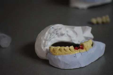 口腔牙齿模型图片 口腔牙齿模型图片