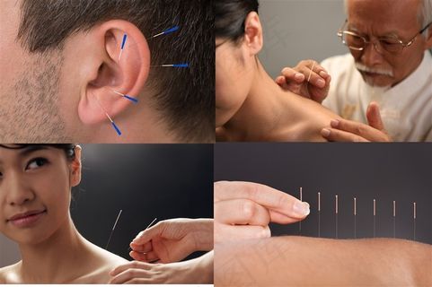 做针灸的性感美女高清图片