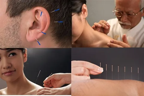 做针灸的性感美女高清图片