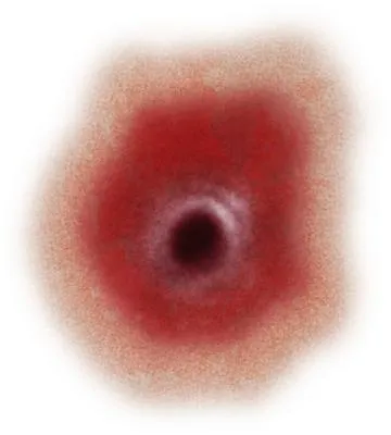 伤口 PNG免抠(360x400)