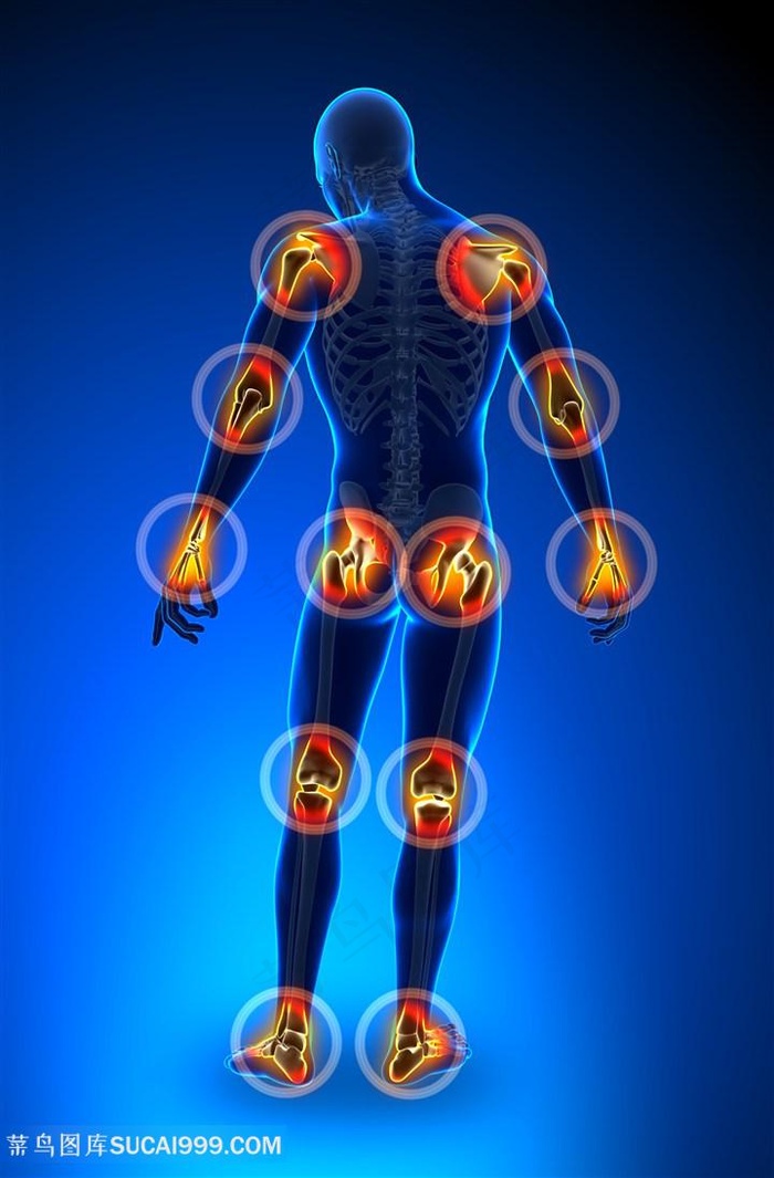关节疼痛部位医疗主题高清图