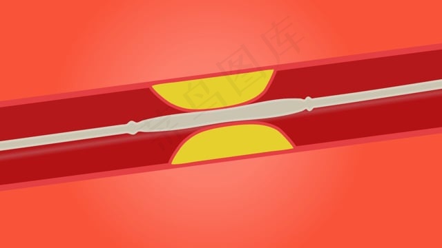 气球, 过程, 血管成形术, 医疗的, 健康, 梗死, 支架