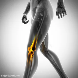 关节疼痛的人物医疗主题高清图
