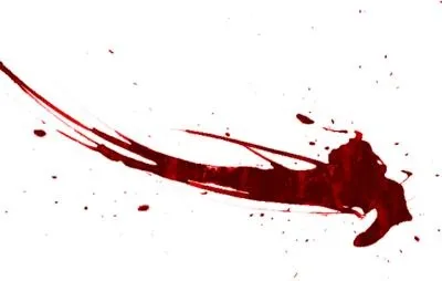血液 PNG免抠(400x254)