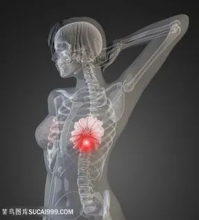 女性乳房疾病透视高清图片