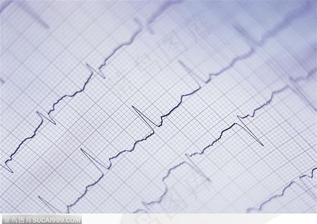 生化试验室-纸上的电波图