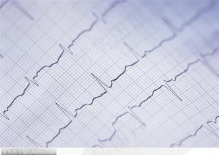 生化试验室-纸上的电波图