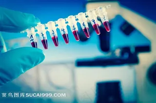 试管里的埃博拉病毒载体液体