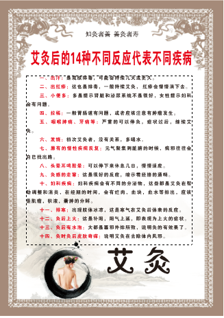 不同反应不同病cdr矢量模版下载