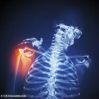 肩部疼痛的人物高清图片