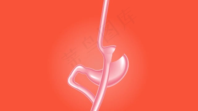 胃手术, 医疗的, 身体, 健康, 腹部, 女士, 关心