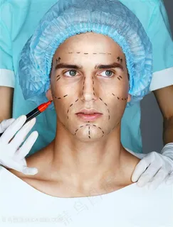 男士脸部画线准备做手术图片