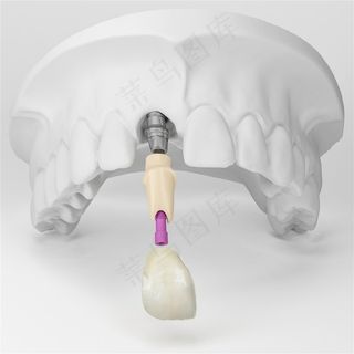 牙齿塑料模型图片