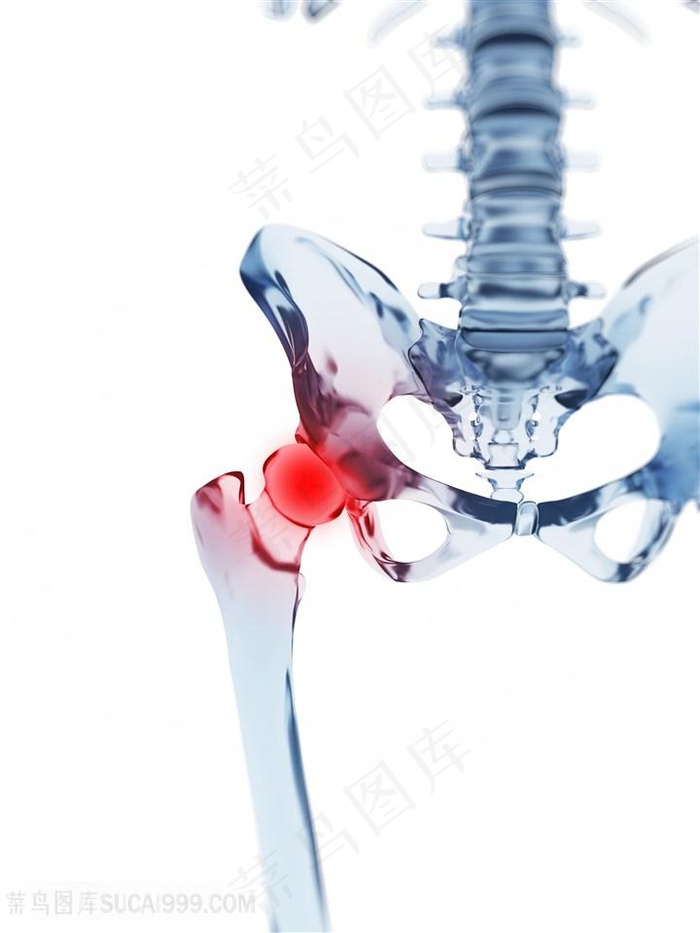 关节疼痛医疗主题高清图