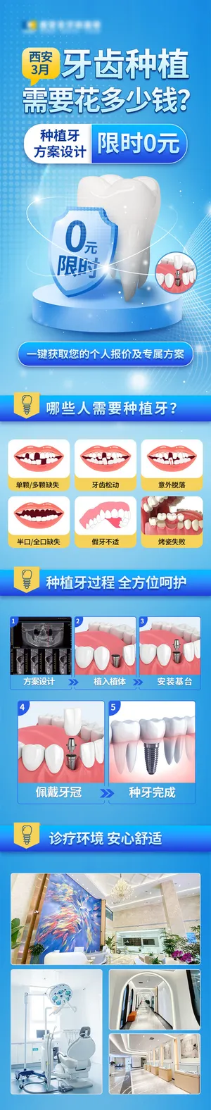 种植牙测价页面
