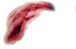 疤痕 PNG免抠(256x164)