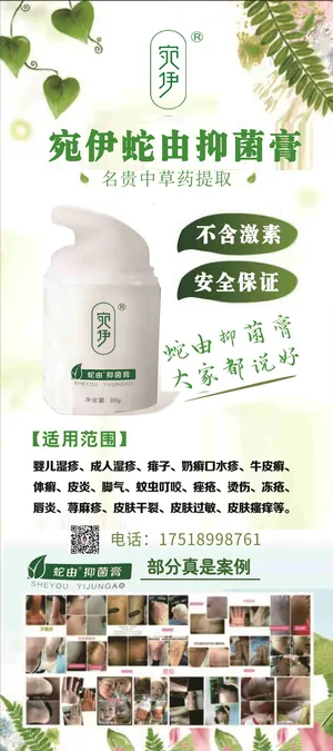 宛伊蛇由抑菌膏展架 宛伊化妆品海报  化妆品宣传海报