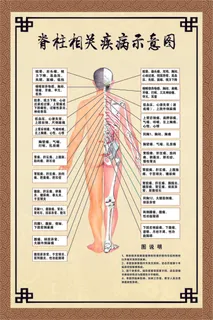 脊柱相关疾病示意图