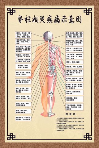 脊柱相关疾病示意图