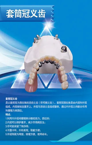 套筒冠口腔|医院|展板|制度|口腔医院展板