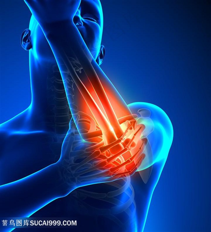手关节疼痛医疗主题高清