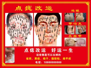 红色接地气点痣图摆摊图