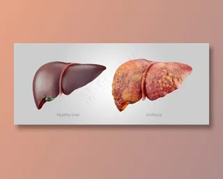 吸烟前后肝脏对比高清图片