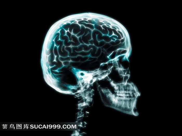 人体大脑透视图素材